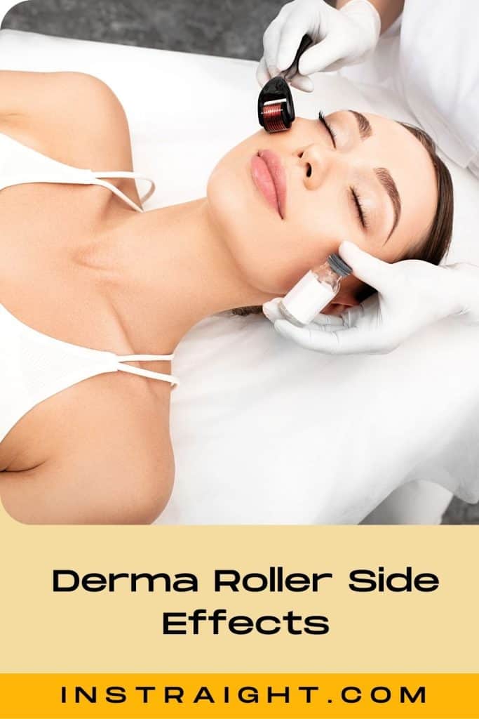 A lady receiving derma roller facial treatment